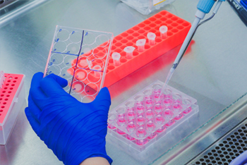 Cell Culture Media Analysis